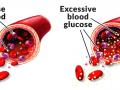 HEALTH : ​रक्तातील साखरेची पातळी कशी ओळखाल? - Marathi News | HEALTH: How will blood sugar levels be identified? | Latest health News at Lokmat.com