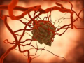 कर्करोगाच्या पेशी नष्ट करणार्‍या बायोजेलची निर्मिती - Marathi News | Creating a biocase that destroys cancer cells | Latest fashion News at Lokmat.com
