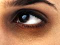 डोळ्यांखाली वर्तुळे कमी करण्याचे उपाय - Marathi News | Measures to reduce the cycles under the eyes | Latest beauty News at Lokmat.com