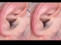 कानावर केस जीवघेणे आजार - Marathi News | Hair Loss Disease | Latest beauty News at Lokmat.com