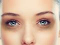 डोळ्यांखालील काळ्या वर्तुळांची समस्या - Marathi News | The problem of black circles under the eyes | Latest health News at Lokmat.com