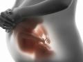 कॅन्सरग्रस्त गर्भवतीवरही उपचार शक्य - Marathi News | Treatment can be done even on cancerous pregnant women | Latest beauty News at Lokmat.com