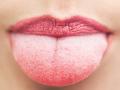 जीभ जळाल्यानंतर करा हे घरगुती उपचार - Marathi News | Do Home Remedies After Burning the Tongue | Latest beauty News at Lokmat.com