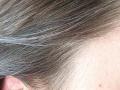 ​HEALTH : पिकलेल्या केसांपासून मिळवा मुक्ती ! - Marathi News | HEALTH: Get rid of ripe hair! | Latest beauty News at Lokmat.com