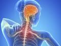 ​‘मल्टिपल स्क्लेरोसिस’वर आधूनिक ईलाज - Marathi News | Modern Treatment on 'Multiple Sclerosis' | Latest beauty News at Lokmat.com
