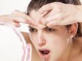 ​पिंपल्स झालेत? - Marathi News | Pimples? | Latest beauty News at Lokmat.com