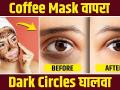 डार्क सर्कलमुळे हैराण आहात? करा हा उपाय | How to Get Rid of Dark Circles | Coffee Eye Mask | - Marathi News | Annoyed by Dark Circles? Do this remedy | How to Get Rid of Dark Circles | Coffee Eye Mask | | Latest beauty Videos at Lokmat.com