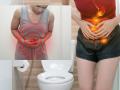 कॉन्स्टिपेशन नेहमी होतं, पोट साफ होत नाही? 6 उपाय- पचन सुधारेल - Marathi News | Constipation problem? 6 Remedies for Improves digestion | Latest sakhi News at Lokmat.com