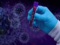 corona virus-कोल्हापूर जिल्ह्यात 26 अहवाल पॉझीटिव्ह,तिघांचा दुसराही अहवाल पॉझीटिव्ह - Marathi News | corona virus- 26 reports positive in Kolhapur district, second report of three positive | Latest kolhapur News at Lokmat.com