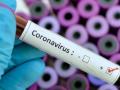 coronavirus : मुंबईला कोरोनाचा विळखा; दिवसभरात 522 नव्या रुग्णांचे निदान, एकूण बधितांची संख्या 4 हजारांवर - Marathi News | coronavirus: 522 new corona positive patients were diagnosed today in Mumbai BKP | Latest mumbai News at Lokmat.com