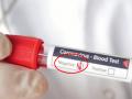 CoronaVirus: महाराष्ट्रातील आणखी एक जिल्हा झाला कोरोनामुक्त, एकमेव रुग्णाला डिस्चार्ज! - Marathi News | corona in sindhudurg - Successful fight with Corona, first positive patient to receive discharge today | Latest sindhudurga News at Lokmat.com