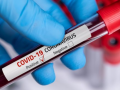 coronavirus : पळसा येथील मुलगी तर बारडमध्ये पोलीस अधिकारी कोरोनाग्रस्त - Marathi News | coronavirus: A girl from Palsa and a police officer from Barad are corona positive | Latest nanded News at Lokmat.com