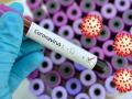 CoronaVirus in Nagpur : कोरोनाचा कहर, ३,३७० पॉझिटिव्ह, १६ मृत्यू - Marathi News | Corona virus in Nagpur: 3,370 positive, 16 deaths | Latest nagpur News at Lokmat.com