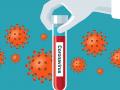 अकोला जिल्ह्यात आणखी ५५ कोरोना पॉझिटिव्ह रुग्ण आढळले - Marathi News | Another 55 corona positive patients were found in Akola district | Latest akola News at Lokmat.com