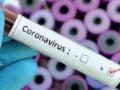 CoronaVirus in Nagpur : नागपुरात परिचारिकेसह २४ रुग्ण पॉझिटिव्ह, रुग्णसंख्या ५८३ - Marathi News | In Nagpur, 24 patients including nurses tested positive, 583 patients | Latest nagpur News at Lokmat.com