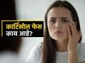 सोशल मीडियात कार्टिसोल फेसची प्रचंड चर्चा, चेहरा पाहून स्ट्रेस सांगणारा नवा ट्रेंड-डॉक्टर म्हणतात.. - Marathi News | What exactly is the cortisol face? See what doctors say about it | Latest sakhi News at Lokmat.com