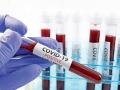 अकोला जिल्ह्यात आणखी १८ कोरोना पॉझिटिव्ह रुग्ण आढळले - Marathi News | Another 18 corona positive patients were found in Akola district | Latest akola News at Lokmat.com