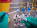  CoronaVirus in Buldhana : १७ जणांच्या अहवालाची प्रतीक्षा - Marathi News | CoronaVirus in Buldhana: 7 person awaiting report | Latest buldhana News at Lokmat.com