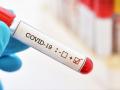 अकोला जिल्ह्यात कोरोनाचे आणखी २५ पॉझिटिव्ह रुग्ण आढळले - Marathi News | Another 25 positive corona patients were found in Akola district | Latest akola News at Lokmat.com