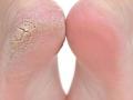 Health Tip: थंडीत तर टाचा फुटतातच, पण उन्हाळ्यात का? झोपण्याआधी करा 'हा' उपाय, मिळेल आराम - Marathi News | Health Tip: Heels crack in the cold, but why in the summer? Do this remedy before going to bed, you will get relief | Latest sakhi News at Lokmat.com