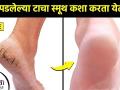 भेगा पडलेल्या टाचांपासून मिळवा सुटका | How to Get Rid of Crack Heels at Home cracked heels treatment - Marathi News | Get rid of broken heels | How to Get Rid of Crack Heels at Home cracked heels treatment | Latest beauty Videos at Lokmat.com