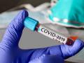 Coronavirus Akola updates : अकोल्यात आणखी ३९३ कोरोना पॉझिटिव्ह - Marathi News | Coronavirus Akola updates: Another 393 corona positive in Akola | Latest akola News at Lokmat.com