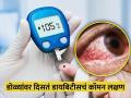 डायबिटीसचं हे आहे सगळ्यात कॉमन लक्षण, दिसताच लगेच डॉक्टरांना भेटा - Marathi News | Diabetes most common symptoms is blurred vision which can affect just one or both of your eyes | Latest health News at Lokmat.com