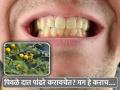 पिवळे दात पांढरे करण्याचे बेस्ट आयुर्वेदिक उपाय, 'या' झाडांची पाने ठरतील फायदेशीर! - Marathi News | Ayurvedic home remedies to make yellow teeth white | Latest health News at Lokmat.com