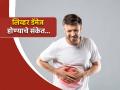 पोटाला किंवा इथे स्पर्श करून कळेल लिव्हर खराब होतंय, दुर्लक्ष करणं पडू शकतं महागात; लगेच करा ही 5 कामे - Marathi News | Liver Damage Symptoms : 5 tips to keep liver healthy | Latest health Photos at Lokmat.com