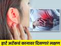 कानात दिसतं Heart Attack चं हे 'सायलेंट' लक्षण, छातीत दुखण्याच्या खूप आधी मिळतो संकेत - Marathi News | Study revealed ear pain and heaviness may be silent symptom of heart attack never ignore it | Latest health News at Lokmat.com