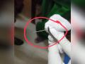 बापरे ! इंजेक्शन देताना सुई रुग्णाच्या शरीरात घुसली - Marathi News | During the injection, the needle came out of the syringe and entered directly into the patient's body | Latest chandrapur News at Lokmat.com
