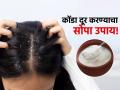 केसांमधील कोंडा दूर करण्यासाठी दह्याचा असा करा वापर, मग बघा कमाल! - Marathi News | How to use curd to get rid of dandruff | Latest sakhi News at Lokmat.com