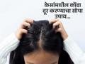 केसांमध्ये अडकून बसलाय चिवट, चिकट कोंडा? करा एक असा उपाय जो कायमची सोडवेल समस्या - Marathi News | Dermatologist tells how to get rid of dandruff with apple cider vinegar | Latest sakhi News at Lokmat.com