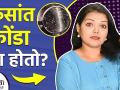 केसांत कोंडा का होतो? | What Causes Dandruff | How to Treat Dandruff At Home | Dandruff Treatment - Marathi News |  | Latest beauty News at Lokmat.com