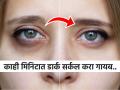 डोळ्याखालच्या काळ्या वर्तुळांमुळे चेहरा निस्तेज-म्हातारा दिसतो? ४ उपाय-काही दिवसात डार्क सर्कल गायब - Marathi News | Home remedies to remove dark circles under eyes naturally | Latest sakhi News at Lokmat.com