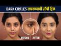 Dark Circles लपवा अगदी सोप्या पद्धतीने | Easy Trick to Hide Dark Circles | How To Hide Dark Circles  - Marathi News | Hide Dark Circles in a very easy way Easy Trick to Hide Dark Circles | How To Hide Dark Circles | Latest sakhi Videos at Lokmat.com