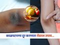 ना ब्लीच, ना क्रीम...कोपर आणि गुडघ्यांचा काळपटपणा दूर करणारा सोपा 'हा' नॅचरल उपाय, ३ दिवसात रिझल्ट - Marathi News | No bleach, no cream...this natural remedy will remove dark elbows and knees; results in 3 days | Latest sakhi News at Lokmat.com
