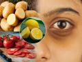 Dark Circles : डोळ्यांखालची काळी वर्तुळं आणि बटाटा-लिंबू-टोमॅटो; डोळे सुंदर दिसण्याचा सोपा उपाय - Marathi News | How to get rid of dark circles naturally : Dark circles and potato-lemon-tomato; An easy way to make your eyes look beautiful | Latest sakhi News at Lokmat.com