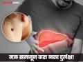 गळ्यावर काळपटपणा आणि चामखीळ लिव्हरच्या 'या' आजाराचा संकेत, जाणून घ्या लक्षणं.... - Marathi News | Liver disease can cause a number of symptoms on the neck | Latest health News at Lokmat.com
