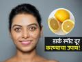 चेहऱ्यावरील डार्क स्पॉट घालवण्यासाठी लिंबामध्ये या ४ गोष्टी मिक्स करून लावा, मग बघा कमाल! - Marathi News | How to use lemon juice to remove dark spots | Latest sakhi News at Lokmat.com