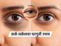 काकडी-बटाटा विसरा! डार्क सर्कल्स, डोळ्यांखालची सूज घालवण्यासाठी सोपा घरगुती उपाय, आठवड्याभरात दिसेल फरक - Marathi News | how to reduce dark circles naturally at Home simple home remedy for under eye puffiness natural treatment for dark circles and eye bags how to remove dark circles in one week | Latest sakhi News at Lokmat.com