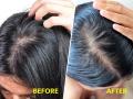 Hair Care Tips : उन्हाळ्यात घामामुळे केस खूप चिपचिपे झालेत? ४ उपाय, केस होतील सिल्की आणि शायनी - Marathi News | Hair Care Tips: Does summer sweat make hair very sticky? 4 remedies, hair will be silky and shiny | Latest sakhi News at Lokmat.com