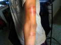 शाळेत नववीच्या विद्यार्थ्यास अमानुष मारहाण - Marathi News | In the school ninth class student brutally beaten | Latest nagpur News at Lokmat.com