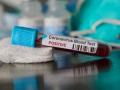 CoronaVirus पत्नीसह पानिपतला जाऊन आला; उस्मानाबादमध्ये पहिला कोरोनाग्रस्त सापडला - Marathi News | CoronaVirus first corona positive patient found in Osmanabad hrb | Latest dharashiv News at Lokmat.com
