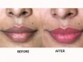 How to get pink lips naturally : मऊ, गुलाबी ओठांना काळपट बनवतात रोजच्या ५ सवयी; अशी घ्या ओठांची काळजी - Marathi News | How to get pink lips naturally : Causes of dark lips hyperpigmentation and black lips remover | Latest sakhi News at Lokmat.com