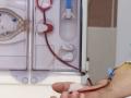 डायलिसिसच्या रुग्णांनो काळजी घ्या : नेफ्रोलॉजी सोसायटीचे आवाहन - Marathi News | Dialysis Patients should take care: Appeal to the Nephrology Society | Latest nagpur News at Lokmat.com