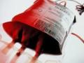 नागपुरातील रक्ताची मागणी २० टक्के घटली, संकलन ८० टक्के कमी - Marathi News | Blood demand in Nagpur fell by 20 per cent, collection by 80 per cent | Latest nagpur News at Lokmat.com