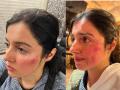 Divya Khosla Injured: अ‍ॅक्शन सीन करताना दिव्या खोसला झाली गंभीर जखमी, फोटो पाहून चाहते पडले चिंतेत - Marathi News | Divya khosla injured while filming an action scene for her upcoming project | Latest filmy News at Lokmat.com