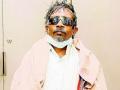बापरे! त्याने तीन वर्ष डोळ्यात वागवला चक्क काटा  - Marathi News | jara Hatke; He had a thorn in his eye for three years | Latest nagpur News at Lokmat.com