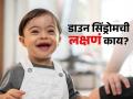 बाळाला डाऊन सिंड्रोम तर नाही, पाहा लक्षणं आणि काय केल्यास बाळासह आईबाबांना मिळते योग्य मदत - Marathi News | What are the symptoms of down syndrome and how to identify it | Latest sakhi News at Lokmat.com